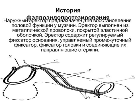 Эректильная дисфункция
