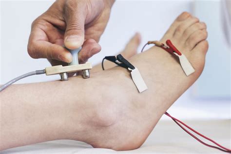 Nerve Conduction Velocity: Overview, Testing, and Results