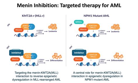 Menin inhibition with revumenib for NPM1-mutated (NPM1m) relapsed or