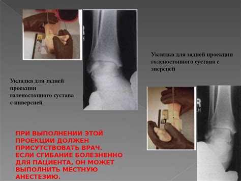 Рентгенография голеностопного сустава - презентация онлайн