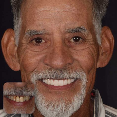 Patient Success Stories - Doctors Implants