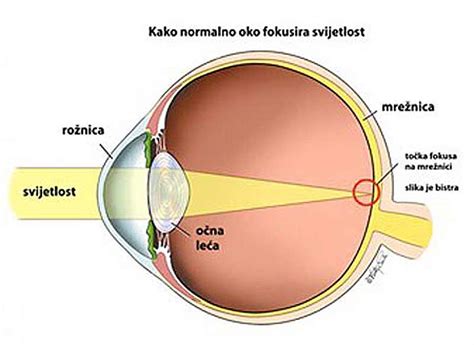 Bolesti oka - Optika Gita