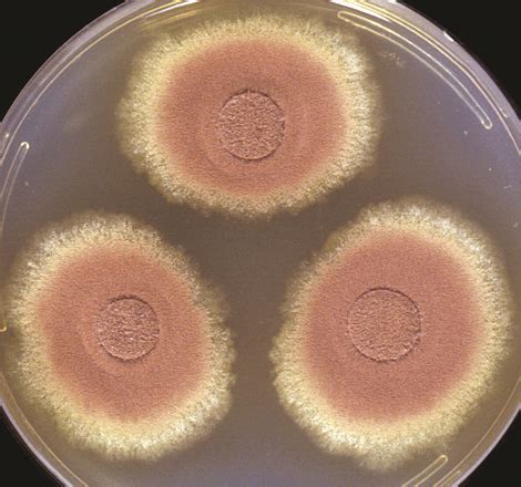Aspergillus | Mycology | University of Adelaide