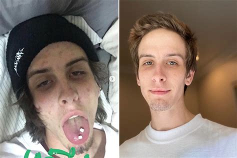 Former drug addict shares photos of stunning transformation