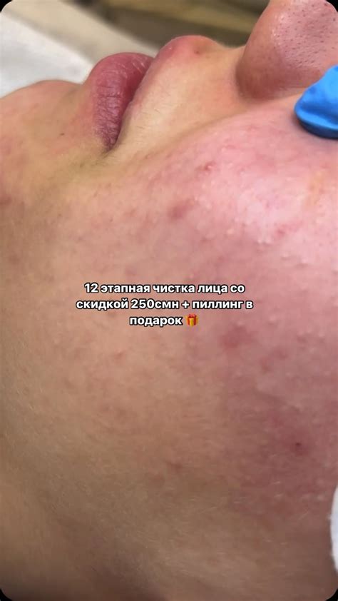 Косметолог | Душанбе | Cosmetologist-aestheticist (@dr.amirkhonovna ...