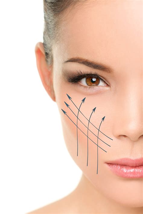 cost of non surgical face lift