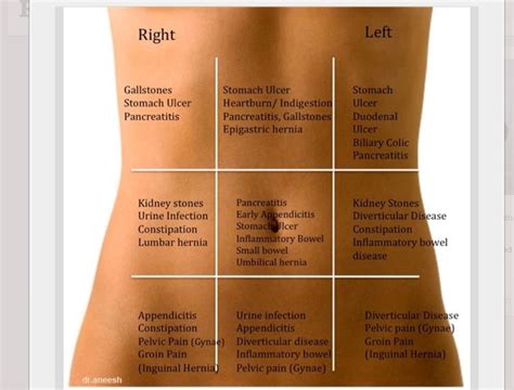 Abdominal Pain Explained Clearly Right Upper Quadrant – eroppa