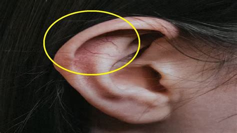 how to get rid of ear pain at night naturally - YouTube