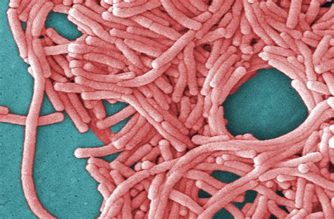 Legionella bacteria found at Pittsburgh hospital | kgw.com