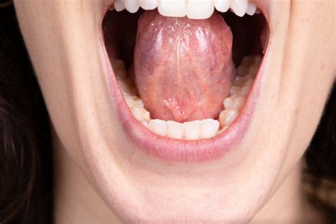 What is Cannabis Sublingual Spray? The Fastest Oral THC