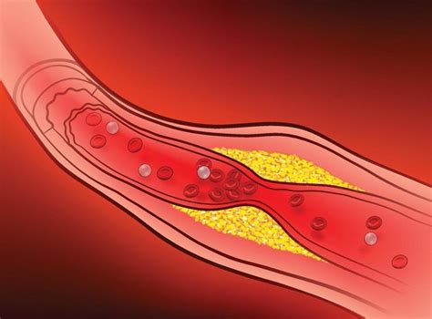 Pin on IV therapy