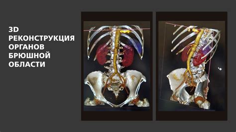 Компьютерная томография КТ у метро Жулебино и Котельники в Люберцах ...