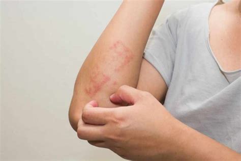 Симптомом каких болезней могут стать пятна на коже? | MedAboutMe