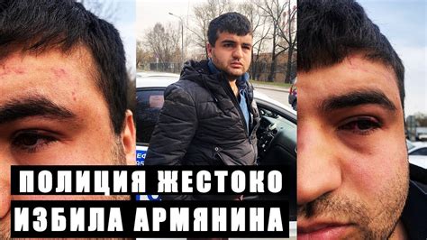 МУСОРА СЛОМАЛИ ЧЕЛЮСТЬ АРМЯНИНУ ! Беспредельщики из ГИБДД сфабриковали ...