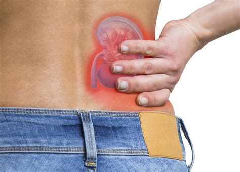 Gout and Kidney Stones: Symptoms, Causes, Treatments