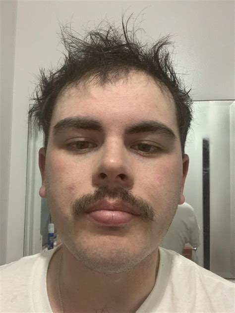 Help me.. my hairline is getting worse, some days I don’t care and some