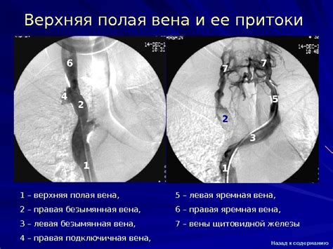 Презентация Ангиография