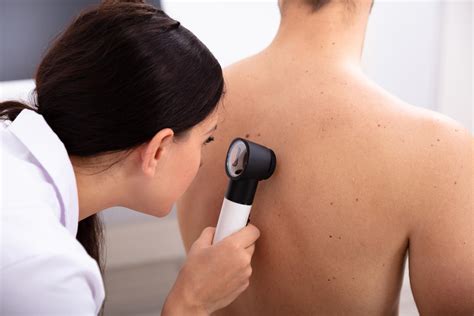 What is Nodular Melanoma?