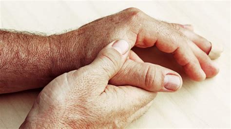 Collagen Vascular Disease | Northwestern Medicine
