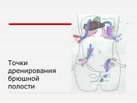 Закрытая травма живота. Перитонит - презентация онлайн