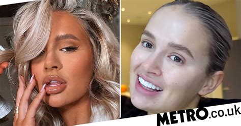 Molly Mae Hague reveals natural lips after having lip filler dissolved ...