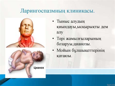 Ларингоспазм. Бронхоспазм - презентация онлайн