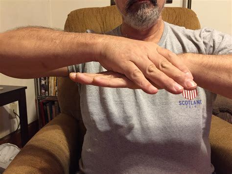 LH tendonitis, thumb/hand joint. Remedies? - Page 2 — DjangoBooks Forum