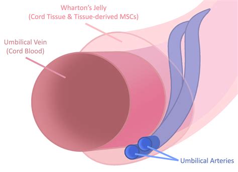 Umbilical Cord Blood Storage - Umbilical Cord Blood Banking ...