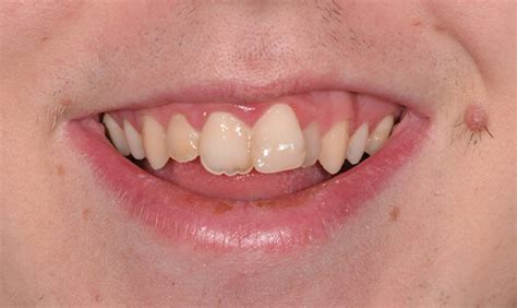 Smile gallery