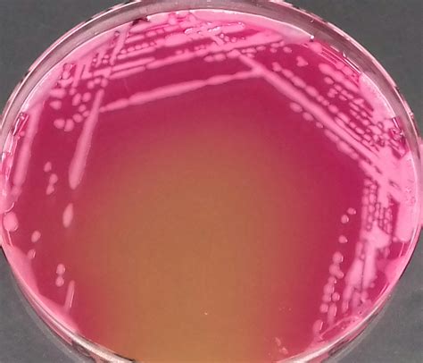 bacillus rmicrobiology