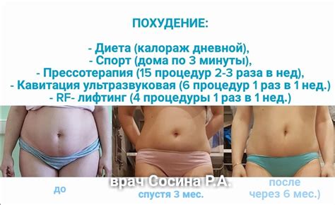 Прессотерапия | Клиника Инновационной Косметологии DoctorSOS
