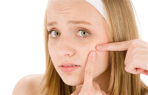 How to Get Rid of Zits Overnight | Khaleej Mag