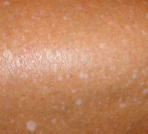small itchy patch  skin  face andromagda