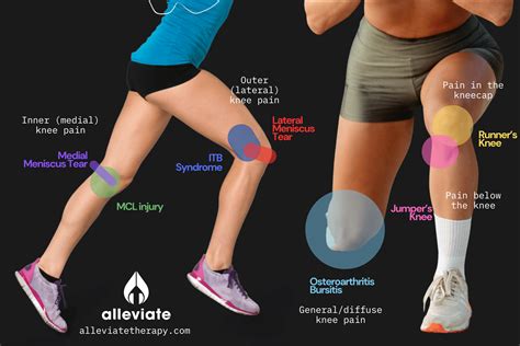 Knee Pain Location Chart: Top Knee Pain Causes by Location – Alleviate