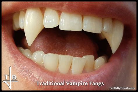 Vampire Teeth By Pickypikachu Vampire Teeth Vampire T - vrogue.co