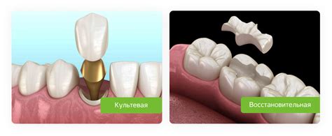 Вкладка на зуб: цена установки, изготовление зубных вкладок — ROOTT