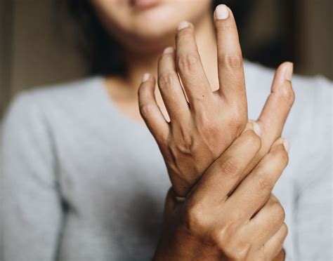 Permanent Wrist Sprain at Kenneth Summers blog