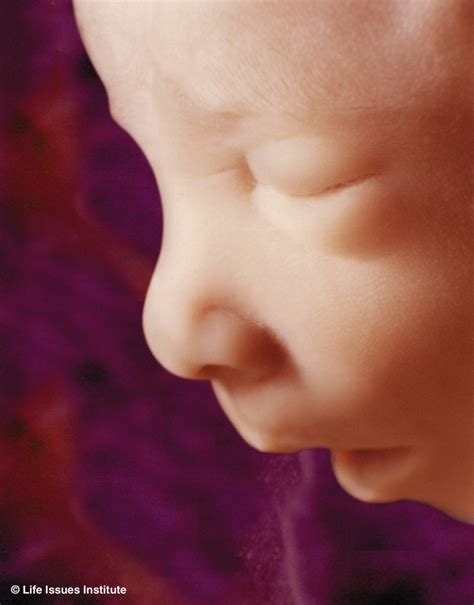 Preborn Baby Pictures | Vastbinder Family