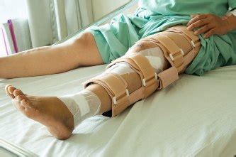 Закрытый перелом бедра: лечение в ЛДЦ на Вернадского