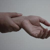 Отекают руки: что делать. Совет