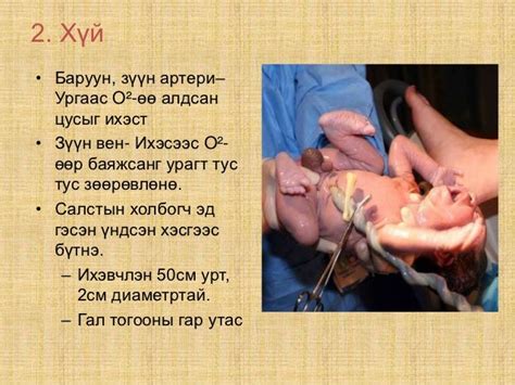 төрөлтийн 3 р үеийн физиологи, эх барихын гэмтэлүүд
