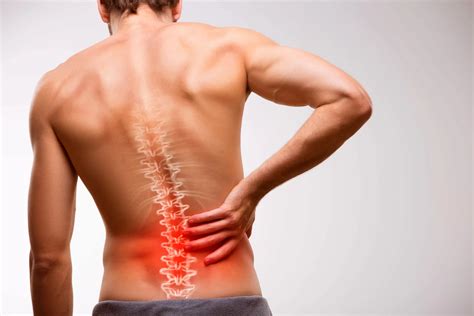 What Causes Sciatic Nerve Pain - Fortitude Chiropractic