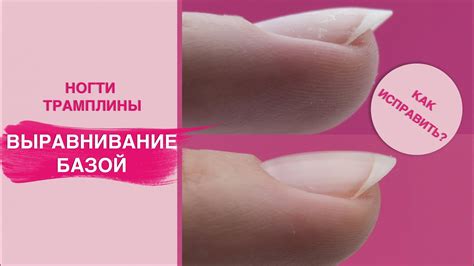 ВЫРАВНИВАНИЕ НОГТЕВОЙ пластины базой. Исправление трамплинообразных ...