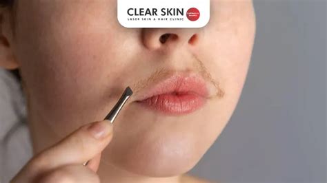 Unwanted Hair Removal On Face Clearance | cityofclovis.org