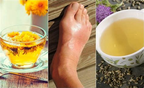 the 5 Best Natural Teas for Reducing Uric Acid Levels