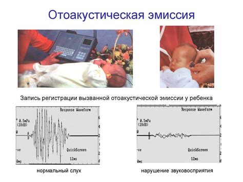 Гнойные заболевания уха. Болезнь Меньера. Отосклероз. Нейросенсорная ...