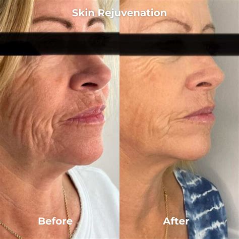 Jw Woodward: Before & After Results That Will Shock You Image 19