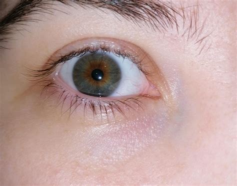 CH? : r/heterochromia