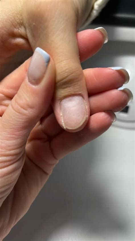 Ремонт ногтей. Наращивание на верхние формы. | Nails, Beauty