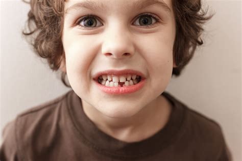 Denti da Latte: Guida Completa e Consigli Utili - Kikido